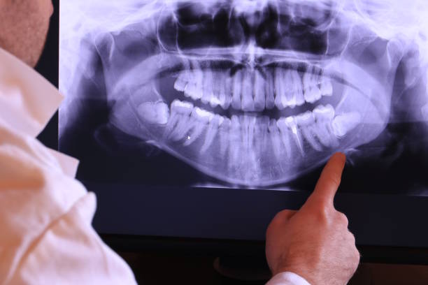 Best Walk-In Emergency Dentist in White City, UT